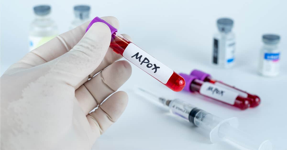 Recognizing Mpox Symptoms and When to Seek Care